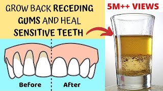 Heal Receding Gums and Grow Back  Treat Sensitive Teeth and Reverse Receding Gums  Gingivitis [upl. by Myrtice]