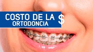 ¿Cuánto cuesta ponerse brackets  Odontoespecialistas [upl. by Oscar105]