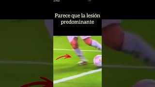 Esguince de tobillo de Leo Messi doctorjuancarlosalbornoz esguince [upl. by Honorine]