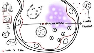 Pneumocystis jirovecii  Pneumocystis pneumonia [upl. by Herson]