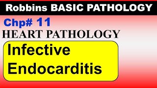 Chp11 Robbins Patho  Heart Pathology  Infective Endocarditis  Dr Asif Lectures [upl. by Hairahcez]