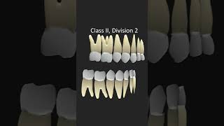 Angles Classification of Malocclusion shorts dentistry orthodontics [upl. by Ztnaj]