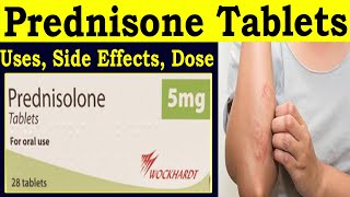 Prednisone 5 mg Tablet  Prednisone 20 mg Tablet  Uses Side Effects Dose [upl. by Yelserp]