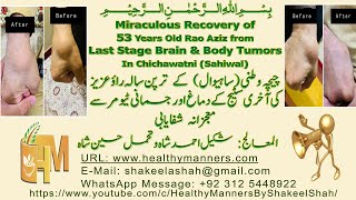 Miraculous Recovery of 53 Years Old Rao Aziz from Last Stage Brain amp Body Tumors In Chichawatni [upl. by Harlie77]