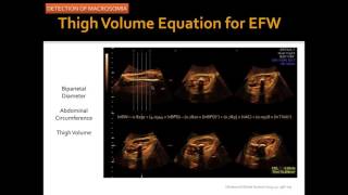 AIUM Webinar Evaluating the Fetus at Risk for Shoulder Dystocia [upl. by Nivahb22]