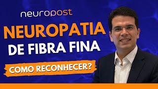 Neuropatia de Fibras Finas  Uma Polineuropatia Peculiar [upl. by Ennaeiluj]