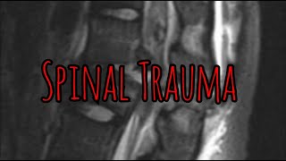 Prolonged Field Care Podcast 204 Spinal Trauma [upl. by Till277]