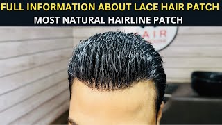 Premium Lace Hair Patch  Full Information About Frontlace Hair patch  Hair wig house [upl. by Hailey]