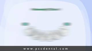 Ask Gordon Implants and removable partial dentures [upl. by Nikola804]