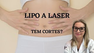 Lipo a laser tem cortes [upl. by Assilak]