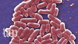 E coli infections are gross Here are 5 facts you cant unlearn about them [upl. by Nylecyoj840]