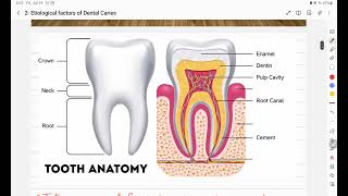 ZU Dental Carilolgy 2 Etiology of dental caries [upl. by Bamberger]