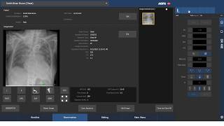 AGFA Musica Spellman HFe Single Console Integration [upl. by Simeon509]