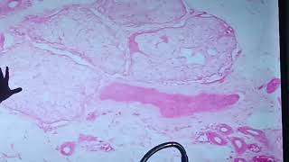 HISTOLOGIA TEJIDO EPITELIAL GLANDULAR  ucsur [upl. by Lorenzo508]