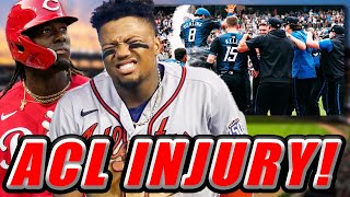 Ronald Acuña Jr SEASONENDING ACL SURGEY [upl. by Kalbli]