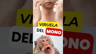 📛Descubre los Síntomas de la VIRUELA del MONO virueladelmono mpox [upl. by Carlton599]