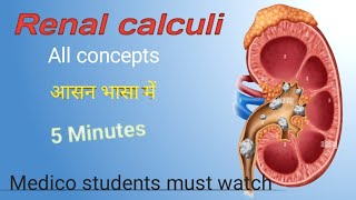 Renal calculi ll Renal stone ll Excretory system disorder ll Nephrolithiasis ll urolithiasis ll [upl. by Ogawa284]