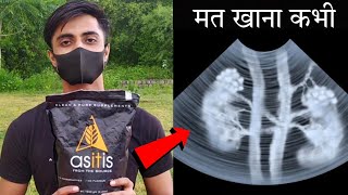 ASITIS Side Effects  हो गया खुलासा इस सस्ते ब्रांड का  Asitis Review protein gymlife [upl. by Alissa]