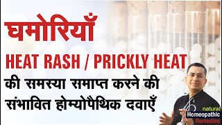 घमोरियाँ  Heat Rash  Prickly Heat  Natural homeopathic remedies with symptoms [upl. by Peony800]