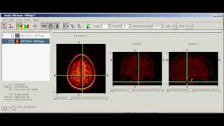 AMIDE 3D Imaging Software [upl. by Dafna]