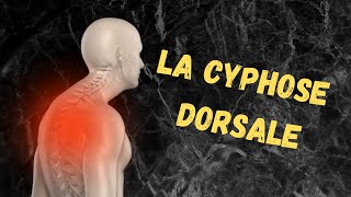 Cyphose Dorsale [upl. by Hilarius]