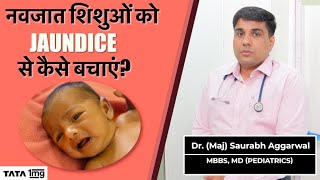 neonatal jaundice  बच्चो में jaundice in के causes symptoms और treatment [upl. by Sirhc]