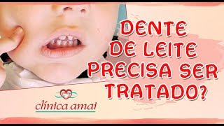 Dente de Leite precisa ser Tratado Com Dra Carnem Silvia Dentista da Clínica Amai [upl. by Rehotsirhc]