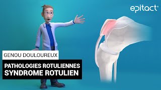 Syndrome Rotulien  Explication  EPITACT [upl. by Aninep141]