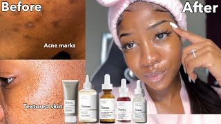 PRODUCTS THAT REMOVE DARK MARKS amp TEXTURED SKIN FAST  The ordinary [upl. by Ycul75]