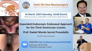 İON 429 Lecture Prevedello Expanded Endoscopic Endonasal Approach for the 3rd Ventricular Lesions [upl. by Hodgson122]