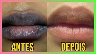 Como clarear os labios escuros causados do fumo [upl. by Akcimahs]