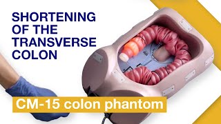 Basic Techniques of Colonoscope Insertion  Exercise 4 Shortening of the transverse colon [upl. by Yduj]