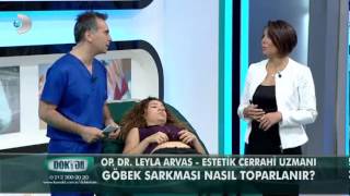 Göbek sarkması nasıl toparlanırOp Dr Leyla Arvas [upl. by Alioz]