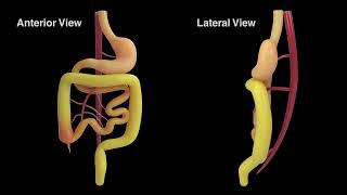 New Revelations in the Pathophysiology and Surgical Management of Congenital Gut Malrotation [upl. by Admana]