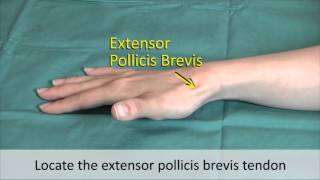 Musculoskeletal Examination and Joint Injection Series DeQuervains Tenosynovitis Injection [upl. by Ynnek772]