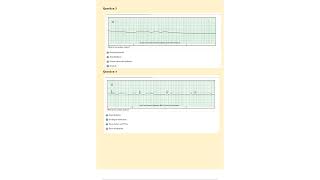 Relias DYSRHYTHMIA BASIC A Exam 2023 Exam Elaboration Questions and Answers Graded A 100 Correct A [upl. by Hicks]