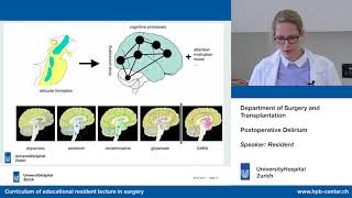 Postoperative Delirium – Please participate in our 3minute survey below [upl. by Enyleve]