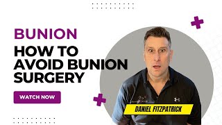 How To Avoid Bunion Surgery and Keep Active [upl. by Norrie]