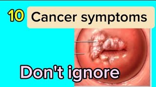 10 symptoms of Cancer Dont ignore [upl. by Nolahc256]