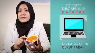 Mengenal Katarak Jenis amp Penyebabnya [upl. by Eentihw185]