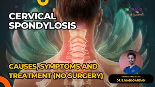 கழுத்து வலி காரணம்  CERVICAL SPONDYLOSIS Treatment NO SURGERY thamizhmaruthuvan cervicalpain [upl. by Seidnac]