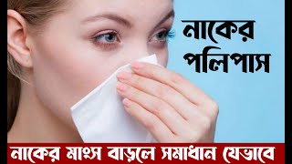 Nose Polyps Treatment Bangla  নাকের পলিপাস দূর করার উপায় । POLYMED [upl. by Kostman]