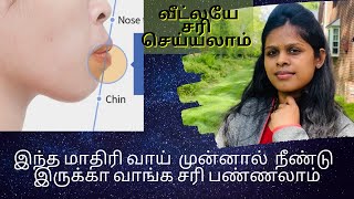 How to get rid of protruding mouth and lips naturally  வீட்லயே வாய் நீளமாய் இருப்பதை சரியாக்கலாம் [upl. by Ayela]