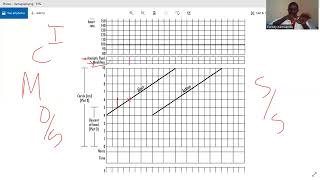 partograph OSCE [upl. by Upton748]