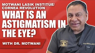 What is Astigmatism in the Eye [upl. by Riocard]