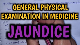 Jaundice  General Physical Examination in Medicine  Final Year MBBS Practical Exam [upl. by Hedley]