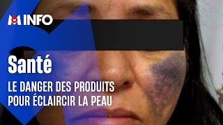 Ces produits pour éclaircir la peau qui font tâche [upl. by Seana156]