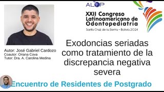 ER116 334 Exodoncias seriadas como tratamiento de la discrepancia negativa severa [upl. by Adalheid666]