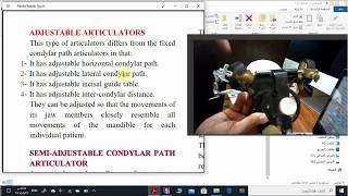 semiadjustable articulator 1 [upl. by Ardys]