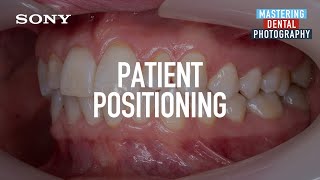 Dental Photography How to position the patient [upl. by Anneehs278]